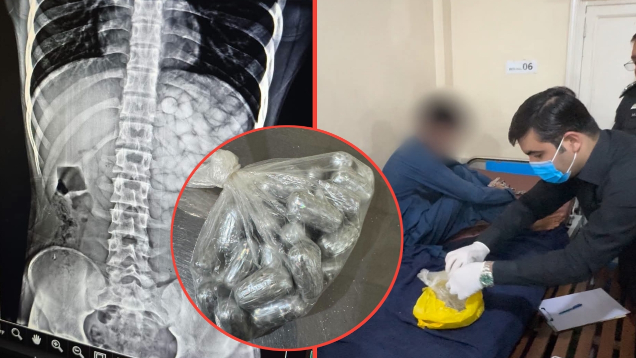 ایکسائز انٹیلیجنس بیورو نے بین الاقوامی منشیات اسمگلر کو  گرفتار کرلیا، ملزم کے پیٹ سے 66 عدد گولیاں 462 گرام  آئس بھرے کیپسول گولیاں برآمد